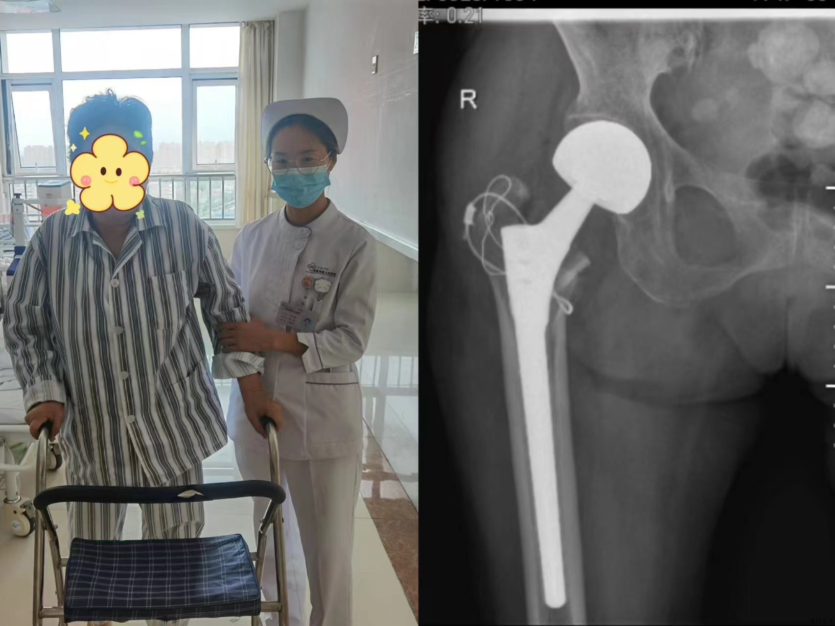 70e19b8a5487430a891599960a6fe40f.png 70e19b8a5487430a891599960a6fe40f.png