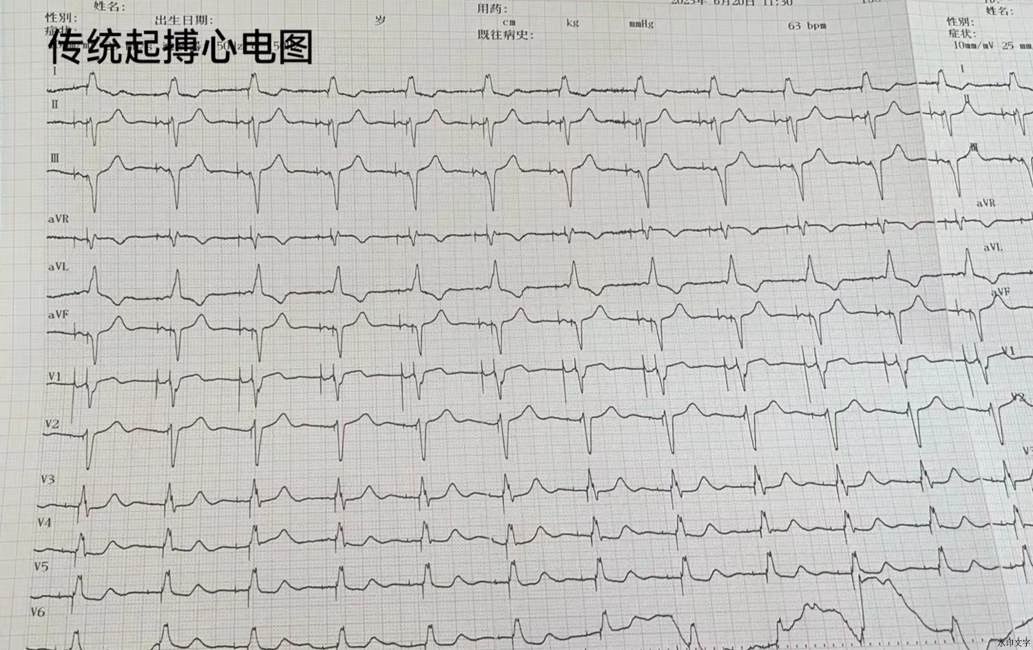 8316d4eeda59452f90819ee6387ec8d4.png