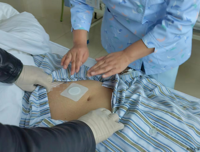 中医穴位贴敷 治痛有良效