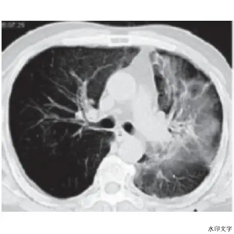 ff939317e4eb4a908bfdfce695dee8bc.png ff939317e4eb4a908bfdfce695dee8bc.png