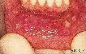 e75c08fe4cf7463aae26e3cf7a0cf7ca.png e75c08fe4cf7463aae26e3cf7a0cf7ca.png